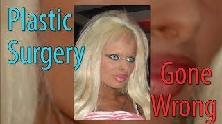 Plastic Surgery Gone Wrong - PSC Uncut - Ep.10