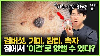 집에서 한번에 쏙! 제거하는 방법?ㅣ검버섯, 기미, 잡티, 흑자, 점 고민이라면 이 영상 꼭 끝가지 보세요!