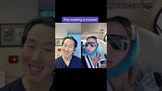 Plastic Surgeon Reacts to Amazing Jaw Surgery REVEAL! #shorts #jawsurgery