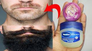 How to grow beard faster naturally at home with onion and vaseline | Beard growth oil