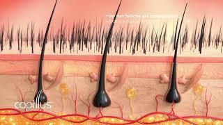 How  Hair Loss Occurs and How to Help Stop It