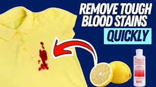 How to Clean Blood Stains on Clothes With These Easy Tricks