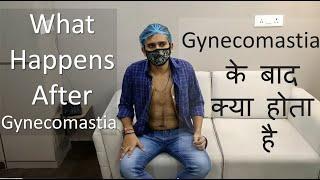 Gynecomastia Recovery - explained by a patient himself in Hindi.Surgery at Rejuva Aesthetica Gujarat