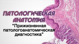 Клиническая патологическая анатомия №2 "Прижизненная патологоанатомическая диагностика"