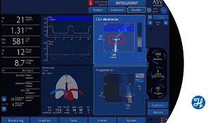 How to shift the PetCO2 target range in INTELLiVENT-ASV