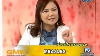 Measles: Causes and Symptoms