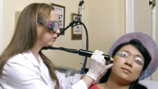 What is Alex TriVantage?  Lasers for Unwanted Brown Spots - Michele Green, NYC Dermatologist