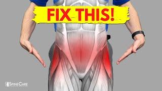 How to Fix Pelvic Pain FOR GOOD