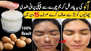 Homemade POTATO CREAM To Remove Face Pigmentation Naturally-Remove Dark Spots & Melasma In 15 Days