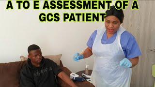 A TO E ASSESSMENT OF A GCS PATIENT SIMPLIFIED