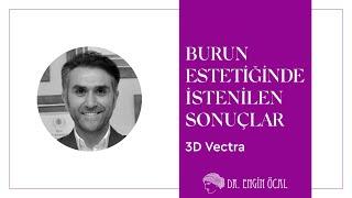 3D Vectra Burun Estetiği