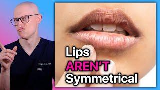 Your Lip Lift WON'T Be Symmetrical! | Dr. Gary Linkov