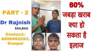 Jaw Reconstruction Surgery || Jaw Cancer || Part - 2 || @rajnishsahu82