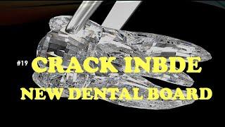 NEW INBDE EXAM 2020 | Integrated National Board Dental Examination |