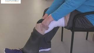 Below Knee Prosthetic Application