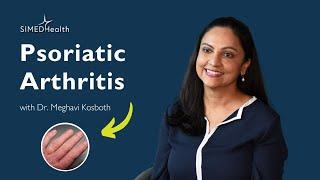Psoriatic Arthritis: Symptoms & Treatment
