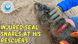Injured Seal Snarls At His Rescuers