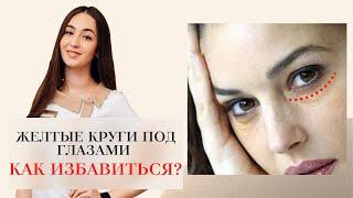 ЖЕЛТЫЕ КРУГИ ПОД ГЛАЗА   КАК ИЗБАВИТЬСЯ ОТ КРУГОВ ПОД ГЛАЗАМИ⁉️