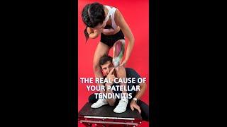 The Real Cause Of Your Patellar Tendonitis