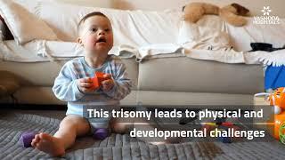Down Syndrome: Explained in a Minute | Child with Down Syndrome
