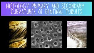 Histology of Primary and Secondary Dentinal Tubule Curvatures - Dentistry