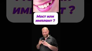 Что такое мост ? #лечениезубовмосква #зубымосква #стоматолог
