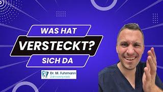 Was hat sich da versteckt  | Zahnarzt Dr. Maximilian Fuhrmann