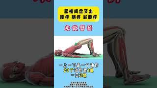 硬核健康科普行动 腰椎间盘突出 抖出健康知识宝藏 脊柱微创