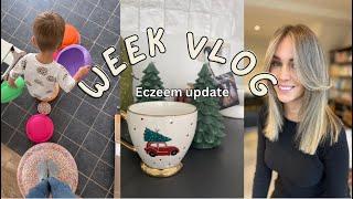 ACTION SHOPLOG, KAPSTER & STAPELSTEIN GROW / VLOG 7-2024