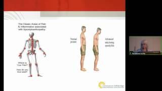 Managing physical activity with inflammatory arthritis