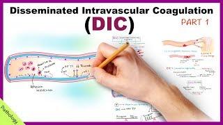 DIC: Disseminated Intravascular Coagulation / Part 1