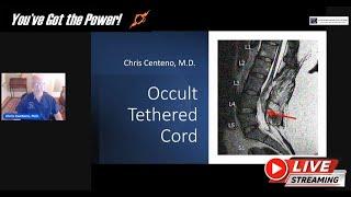 Occult Tethered Cord: How is This Diagnosed?