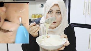 وداعا العمليات التجميل و البوتوكس كوري يصغرج 20سنه معالج التجاعيد وعلامات شيخوخه ونضاره بشره