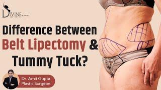 What is the Difference between Belt Lipectomy & Tummy Tuck?