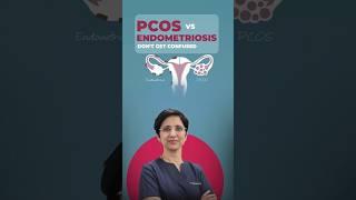 PCOS vs. Endometriosis: The BIG Difference No One Talks About!  | Must-Know Women’s Health Facts