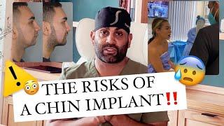 What are the RISKS of a chin implant!? *MUST WATCH BEFORE SURGERY*