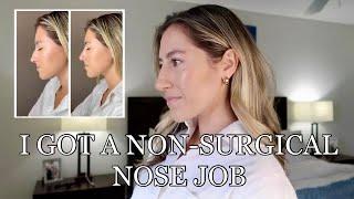 I Got A Liquid Nose Job From the Nose Nurse on Instagram!