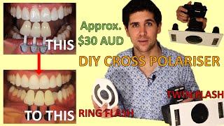 How To Make DIY Cross Polariser Filter At Home For Dental Photography (Ring Flash and Twin Flash)