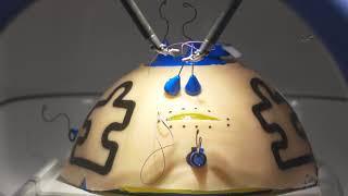 Fundamentals of Robotic Surgery Training Dome Promo Video