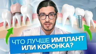 Что лучше имплант или коронка? Что лучше выбрать: имплант или коронку и в каких ситуациях?