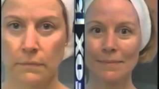 enliven Perfector - Russell Rhodes exclusive, in FOX13 News about Perfector FaceLift