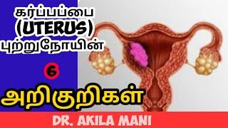 uterus cancer symptoms in tamil. uterine cancer in tamil. Dr. Akilamani. கர்ப்பப்பை புற்றுநோய்.