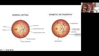 Microvascular Complications in Diabetes with Dr. Margo Hudson - November 18, 2024