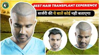 Best Hair Transplant in Guwahati | Best Hair Transplant Result & Cost in Guwahati