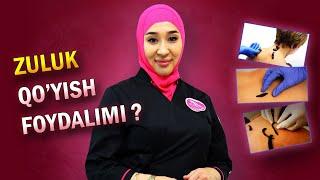 ZULUK qo’yish haqida ma’lumot⁉️#video#massage#zuluk#foydali#youtube#top#reels#uzbekistan#buxoro