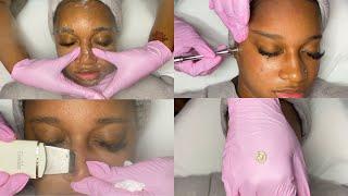 Summer Glow Facial w/ Microdermabrasion | GlamByLiaLeigh