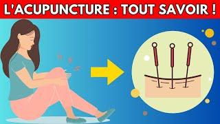 Qu'est-ce que l'Acupuncture et ses Bienfaits : Guide Débutants ! | Santé et Bien-être - Dr Santé