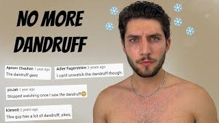 I Got Rid Of 90% Of My Dandruff/Seborrheic Dermatitis With One Simple Change