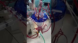 Cardiopulmonary bypass