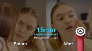 Comper®| Comper Samrkin is the best beauty device? skincare device??(AMAZING!)
